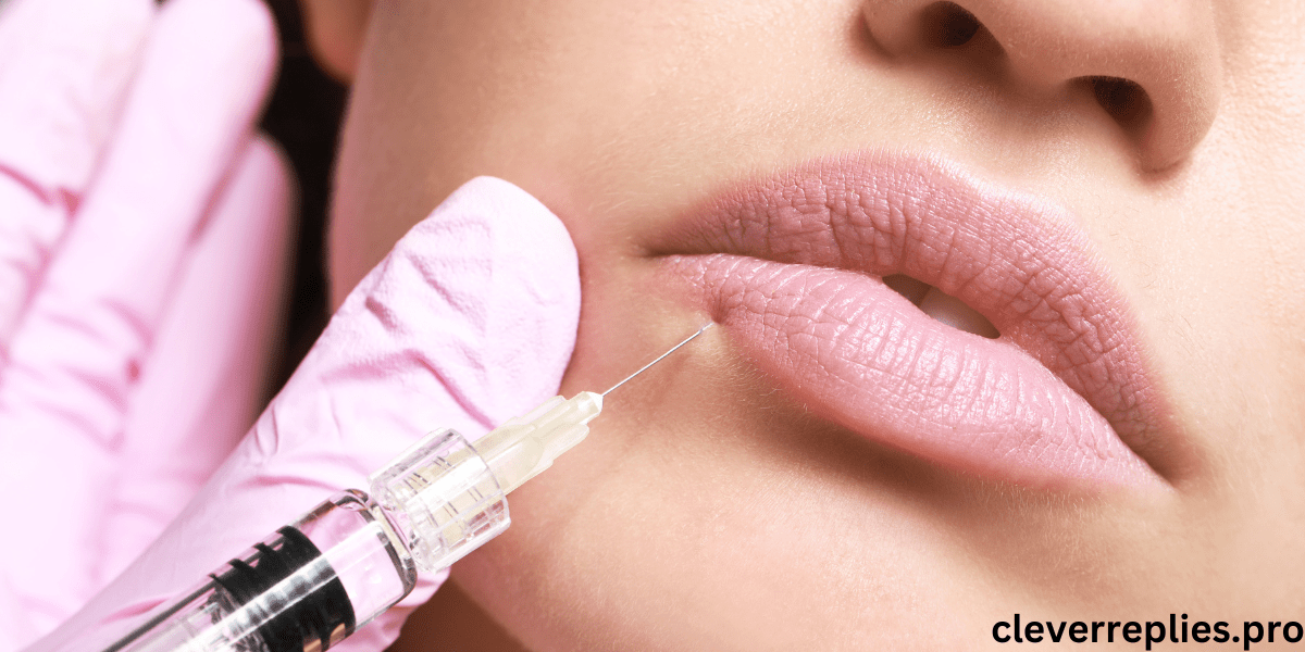 lip fillers near me